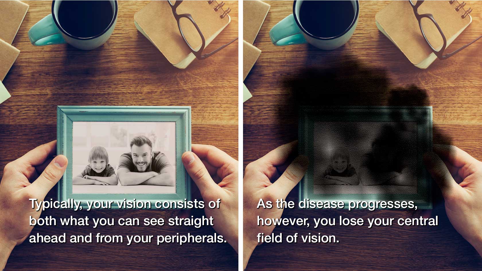 two photos comparing sight with and without AMD